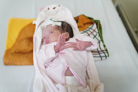 Phẫu thuật cắt bỏ khối u bạch huyết hơn 1kg cho bé gái 10 ngày tuổi - Ảnh 3. Phẫu thuật cắt bỏ khối u bạch huyết hơn 1kg cho bé gái 10 ngày tuổi - Ảnh 3.