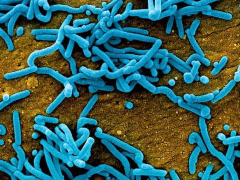 Thợ săn virus - Những người săn lùng hiểm họa - Kỳ cuối: Cuộc chiến trường kỳ với tử thần giấu mặt - Ảnh 3. Thợ săn virus - Những người săn lùng hiểm họa - Kỳ cuối: Cuộc chiến trường kỳ với tử thần giấu mặt - Ảnh 3.