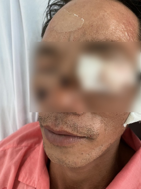 Bất ngờ khi TP.HCM tiếp nhận nhiều tai nạn thương tâm do pháo - Ảnh 1. Bất ngờ khi TP.HCM tiếp nhận nhiều tai nạn thương tâm do pháo - Ảnh 1.