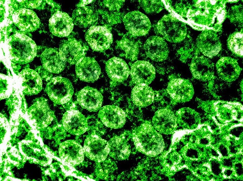 Phát hiện khí ozone có thể khử khuẩn bề mặt có virus corona - Ảnh 1. Phát hiện khí ozone có thể khử khuẩn bề mặt có virus corona - Ảnh 1.
