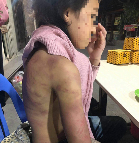 Hà Nội chỉ đạo xử lý vụ bé gái 12 tuổi nghi bị bạo hành, xâm hại - Ảnh 1. Hà Nội chỉ đạo xử lý vụ bé gái 12 tuổi nghi bị bạo hành, xâm hại - Ảnh 1.