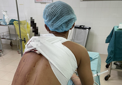 Đang nhậu đòi về, 4 nam thanh niên đâm chém nhau, 2 người nhập viện - Ảnh 1. Đang nhậu đòi về, 4 nam thanh niên đâm chém nhau, 2 người nhập viện - Ảnh 1.