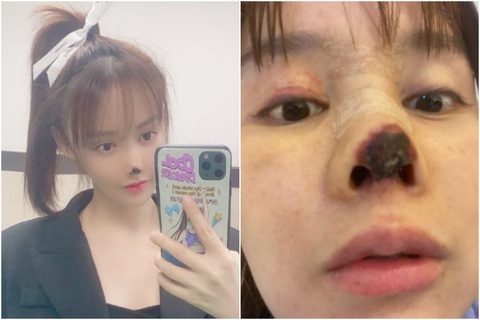Người đẹp Trung Quốc công khai ác mộng thẩm mỹ - Ảnh 1. Người đẹp Trung Quốc công khai ác mộng thẩm mỹ - Ảnh 1.