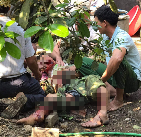 Giập tay, gãy chân vì khoan cục sắt tròn to như quả đạn cối - Ảnh 1. Giập tay, gãy chân vì khoan cục sắt tròn to như quả đạn cối - Ảnh 1.