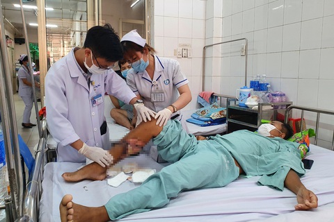 Bò húc người làm thuê gãy xương vai, rách cẳng chân phức tạp - Ảnh 1. Bò húc người làm thuê gãy xương vai, rách cẳng chân phức tạp - Ảnh 1.