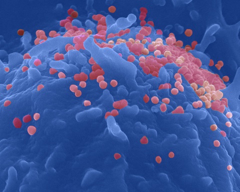 Sắp thử vắc xin ngừa HIV/AIDS trên người sau 8 năm nghiên cứu - Ảnh 3. Sắp thử vắc xin ngừa HIV/AIDS trên người sau 8 năm nghiên cứu - Ảnh 3.