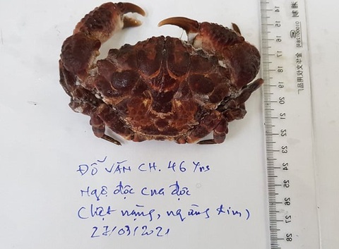 Ăn cua mặt quỷ, một người bị ngộ độc nguy kịch - Ảnh 1. Ăn cua mặt quỷ, một người bị ngộ độc nguy kịch - Ảnh 1.
