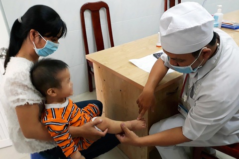 Bệnh tay chân miệng ở Đồng Nai tăng 4-5 lần, nhiều ca trở nặng - Ảnh 1. Bệnh tay chân miệng ở Đồng Nai tăng 4-5 lần, nhiều ca trở nặng - Ảnh 1.
