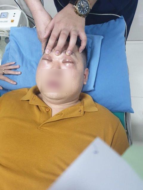 Thanh niên 25 tuổi sốc phản vệ nặng, phù nề, không mở được mắt vì thái 1 củ hành - Ảnh 1. Thanh niên 25 tuổi sốc phản vệ nặng, phù nề, không mở được mắt vì thái 1 củ hành - Ảnh 1.