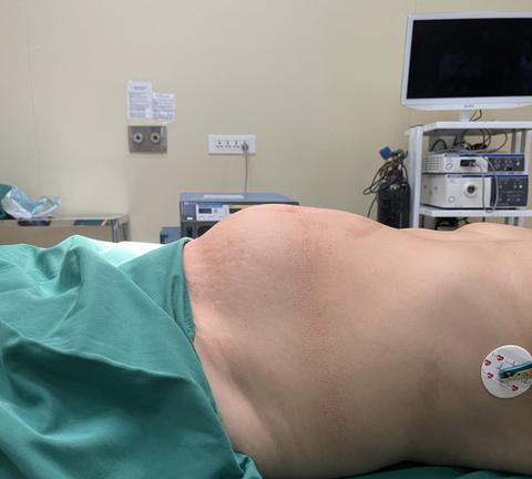 Tự ý điều trị bằng thuốc nam, khối u xơ tử cung to lên 4kg - Ảnh 1. Tự ý điều trị bằng thuốc nam, khối u xơ tử cung to lên 4kg - Ảnh 1.