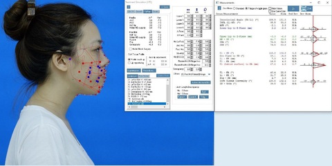 Cô gái 21 năm sống với chiếc lưỡi khổng lồ: Ca cực hiếm, thách thức cả êkip chuyên gia - Ảnh 2. Cô gái 21 năm sống với chiếc lưỡi khổng lồ: Ca cực hiếm, thách thức cả êkip chuyên gia - Ảnh 2.