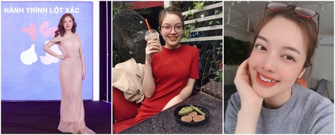 Cô gái 21 năm sống với chiếc lưỡi khổng lồ: Ca cực hiếm, thách thức cả êkip chuyên gia - Ảnh 4. Cô gái 21 năm sống với chiếc lưỡi khổng lồ: Ca cực hiếm, thách thức cả êkip chuyên gia - Ảnh 4.