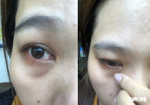 Nhiều phụ nữ hoang mang vì bị nhóm người lạ xịt hơi cay khi đi đường - Ảnh 1. Nhiều phụ nữ hoang mang vì bị nhóm người lạ xịt hơi cay khi đi đường - Ảnh 1.