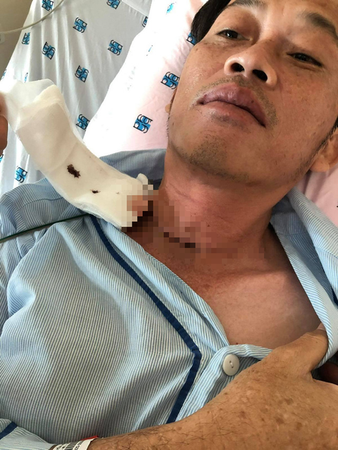 Hoài Linh từng đến Bệnh viện Chợ Rẫy điều trị ung thư tuyến giáp - Ảnh 1. Hoài Linh từng đến Bệnh viện Chợ Rẫy điều trị ung thư tuyến giáp - Ảnh 1.