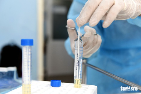 NÓNG: Một ca dương tính COVID-19 làm việc ở Phú Nhuận, TP.HCM - Ảnh 3. NÓNG: Một ca dương tính COVID-19 làm việc ở Phú Nhuận, TP.HCM - Ảnh 3.