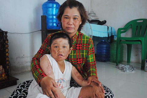 Thương con ai kể tháng ngày - Kỳ cuối: Mẹ bán vé số mong chữa bệnh cho con - Ảnh 1. Thương con ai kể tháng ngày - Kỳ cuối: Mẹ bán vé số mong chữa bệnh cho con - Ảnh 1.