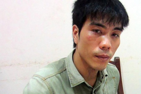 Bệnh viện Tâm thần trung ương 1 bác thông tin bệnh nhân trốn viện điều hành đường dây bảo kê - Ảnh 1. Bệnh viện Tâm thần trung ương 1 bác thông tin bệnh nhân trốn viện điều hành đường dây bảo kê - Ảnh 1.