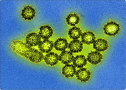 COVID-19 đã giúp diệt được 2 chủng virus cúm quen thuộc? - Ảnh 1. COVID-19 đã giúp diệt được 2 chủng virus cúm quen thuộc? - Ảnh 1.