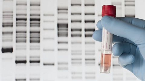 Nghiên cứu mới: Gene gây rối loạn nhịp tim dẫn đến đột tử - Ảnh 2. Nghiên cứu mới: Gene gây rối loạn nhịp tim dẫn đến đột tử - Ảnh 2.