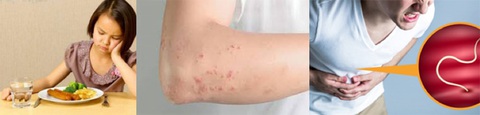 Tết sâu bọ: chỉ bạn cách diệt giun cho cả nhà - Ảnh 1. Tết sâu bọ: chỉ bạn cách diệt giun cho cả nhà - Ảnh 1.