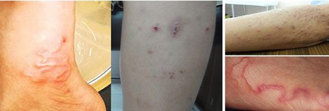 Tết sâu bọ: chỉ bạn cách diệt giun cho cả nhà - Ảnh 2. Tết sâu bọ: chỉ bạn cách diệt giun cho cả nhà - Ảnh 2.