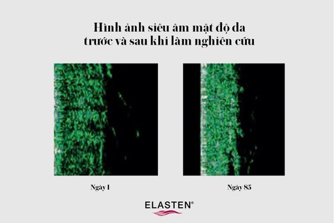 ELASTEN® Việt Nam - Khám phá hiệu quả trẻ hóa làn da theo chuẩn Đức - Ảnh 1. ELASTEN® Việt Nam - Khám phá hiệu quả trẻ hóa làn da theo chuẩn Đức - Ảnh 1.