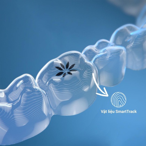 Tại sao nên lựa chọn niềng răng trong suốt Invisalign? - Ảnh 1. Tại sao nên lựa chọn niềng răng trong suốt Invisalign? - Ảnh 1.