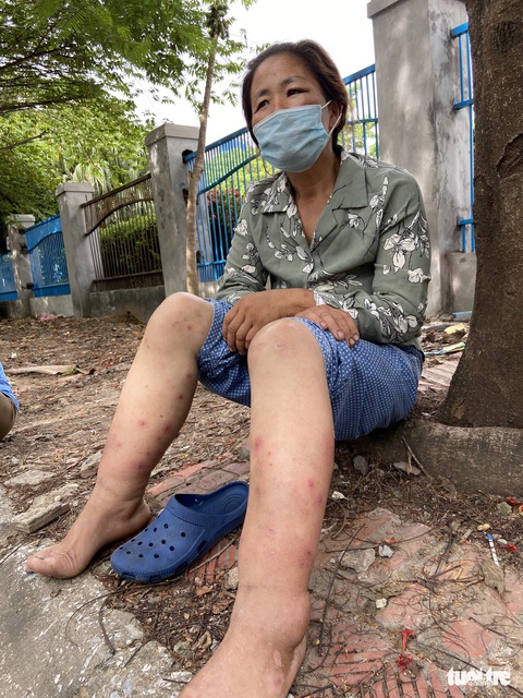 Công nhân môi trường: Nhịn ăn, ngủ ngoài đường, cắn răng chịu từng cơn đau - Ảnh 3. Công nhân môi trường: Nhịn ăn, ngủ ngoài đường, cắn răng chịu từng cơn đau - Ảnh 3.