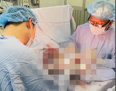 Nối thành công bàn tay bị máy cưa cắt đứt lìa - Ảnh 2. Nối thành công bàn tay bị máy cưa cắt đứt lìa - Ảnh 2.