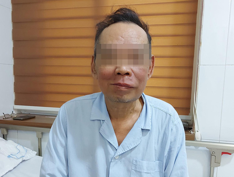 Ung thư khoang miệng đến biến dạng mặt vì không thể đi viện do dịch - Ảnh 1. Ung thư khoang miệng đến biến dạng mặt vì không thể đi viện do dịch - Ảnh 1.