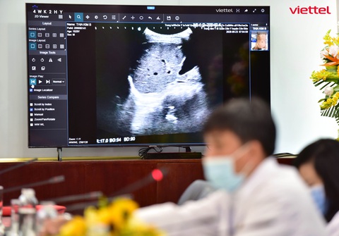 1.800 ca COVID-19 nặng được hội chẩn qua Telehealth - Ảnh 1. 1.800 ca COVID-19 nặng được hội chẩn qua Telehealth - Ảnh 1.