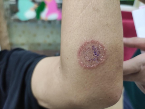Nhiều người bị nấm da do tiếp xúc với chó, mèo - Ảnh 1. Nhiều người bị nấm da do tiếp xúc với chó, mèo - Ảnh 1.