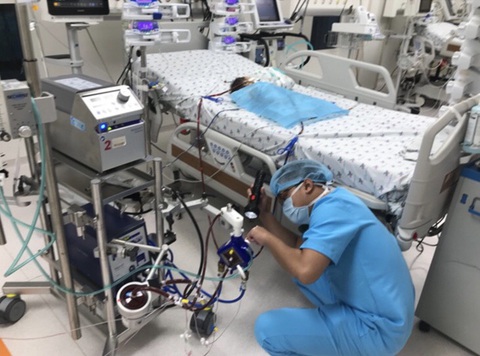 Can thiệp ECMO cứu sống bé sơ sinh 2 ngày tuổi mắc bệnh tim hiếm gặp - Ảnh 1. Can thiệp ECMO cứu sống bé sơ sinh 2 ngày tuổi mắc bệnh tim hiếm gặp - Ảnh 1.