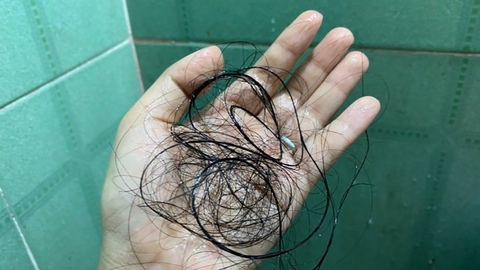 Tăng người bệnh hậu COVID-19 - Ảnh 1. Tăng người bệnh hậu COVID-19 - Ảnh 1.