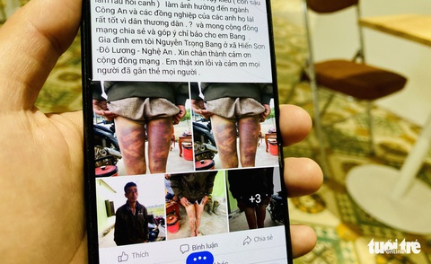 Làm rõ việc người dân tố bị đánh bầm tím ở trụ sở xã - Ảnh 1. Làm rõ việc người dân tố bị đánh bầm tím ở trụ sở xã - Ảnh 1.