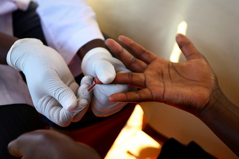 Mỹ phát triển phương pháp tiêu diệt HIV tiềm ẩn trong tế bào - Ảnh 1. Mỹ phát triển phương pháp tiêu diệt HIV tiềm ẩn trong tế bào - Ảnh 1.