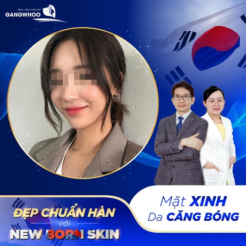 Trẻ hóa da mặt đón xuân sang tại Bệnh viện thẩm mỹ Gangwhoo - Ảnh 2. Trẻ hóa da mặt đón xuân sang tại Bệnh viện thẩm mỹ Gangwhoo - Ảnh 2.