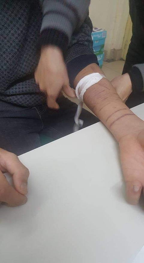 Những người trẻ tự dưng khóc, cười kỳ lạ - Kỳ 2: Dại dột dùng chất gây nghiện để bớt stress - Ảnh 3. Những người trẻ tự dưng khóc, cười kỳ lạ - Kỳ 2: Dại dột dùng chất gây nghiện để bớt stress - Ảnh 3.