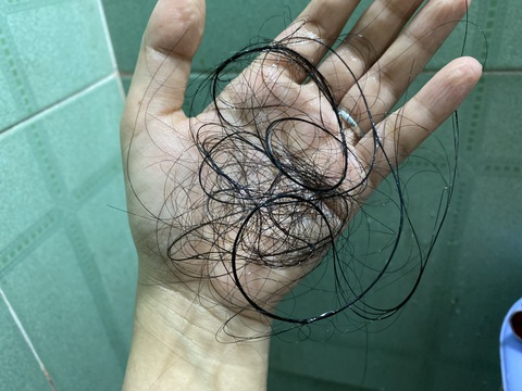 Đàn ông con trai tuổi 30 đã đầu hói, body giảm tông, trị được không? - Ảnh 2. Đàn ông con trai tuổi 30 đã đầu hói, body giảm tông, trị được không? - Ảnh 2.