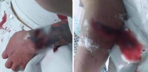 Buổi rượu ‘chào sân’ đàng gái, bạn trai 19 tuổi chém trọng thương cha và cậu bạn gái - Ảnh 1. Buổi rượu ‘chào sân’ đàng gái, bạn trai 19 tuổi chém trọng thương cha và cậu bạn gái - Ảnh 1.