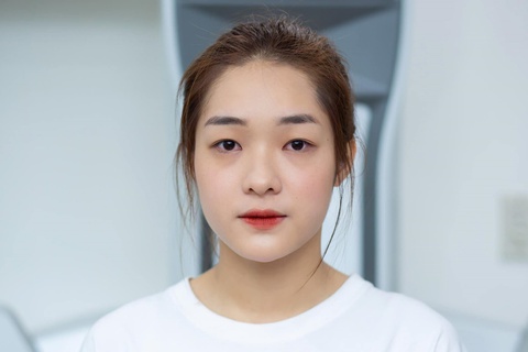 Ảnh trước phẫu thuật thẩm mỹ của Miss Grand Thái Bình gây bão - Ảnh 2. Ảnh trước phẫu thuật thẩm mỹ của Miss Grand Thái Bình gây bão - Ảnh 2.