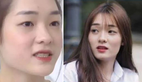 Ảnh trước phẫu thuật thẩm mỹ của Miss Grand Thái Bình gây bão - Ảnh 4. Ảnh trước phẫu thuật thẩm mỹ của Miss Grand Thái Bình gây bão - Ảnh 4.