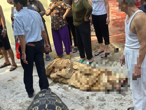 Đòi đất mặt đường, ba người con gái mua xăng đốt mẹ ruột bị thương - Ảnh 1. Đòi đất mặt đường, ba người con gái mua xăng đốt mẹ ruột bị thương - Ảnh 1.