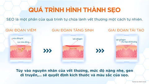 Gợi ý bí quyết để giảm sẹo trong bốn tuần - Ảnh 1. Gợi ý bí quyết để giảm sẹo trong bốn tuần - Ảnh 1.