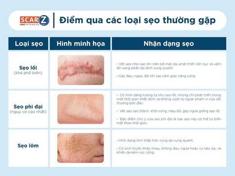 Gợi ý bí quyết để giảm sẹo trong bốn tuần - Ảnh 2. Gợi ý bí quyết để giảm sẹo trong bốn tuần - Ảnh 2.