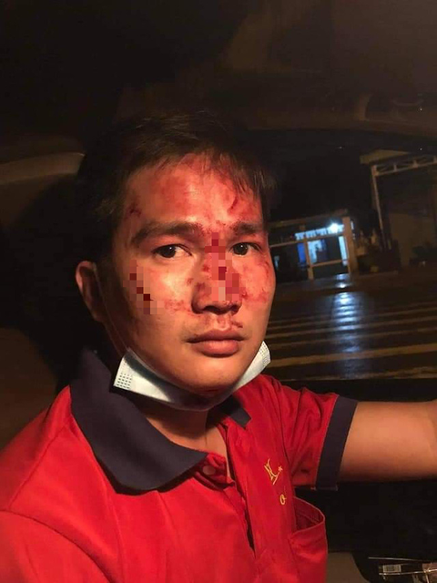 Sau hơn một năm lẩn trốn, nam thanh niên đánh tài xế taxi nhập viện đã bị bắt - Ảnh 2. Sau hơn một năm lẩn trốn, nam thanh niên đánh tài xế taxi nhập viện đã bị bắt - Ảnh 2.