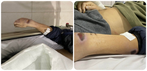 Bắt cựu đội trưởng, đội phó công an huyện vì dùng nhục hình - Ảnh 1. Bắt cựu đội trưởng, đội phó công an huyện vì dùng nhục hình - Ảnh 1.