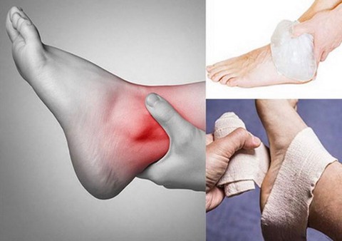 Nhiều người chơi thể thao bị đứt gân Achilles - Ảnh 1. Nhiều người chơi thể thao bị đứt gân Achilles - Ảnh 1.
