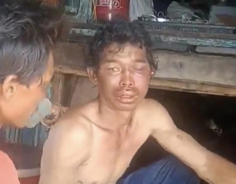 Ba người hành hạ dã man ngư dân trên tàu bị bắt giữ khẩn cấp - Ảnh 1. Ba người hành hạ dã man ngư dân trên tàu bị bắt giữ khẩn cấp - Ảnh 1.
