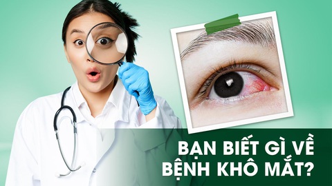 Khô mắt - chứng bệnh ai cũng có nguy cơ mắc phải - Ảnh 1. Khô mắt - chứng bệnh ai cũng có nguy cơ mắc phải - Ảnh 1.